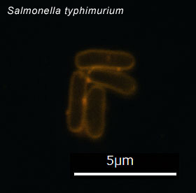 S.typhimurium
