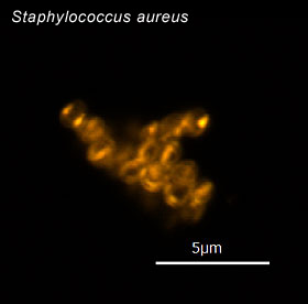 S.aureus