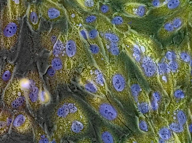 GlycoYELLOW™によるSA-β-gal活性の生体染色v